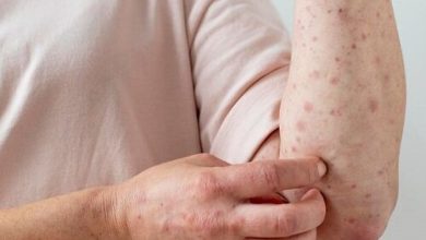 هشدار یک متخصص درباره شیوع بیماری عفونی در فصل بهار/ این نشانه‌ها را جدی بگیرید