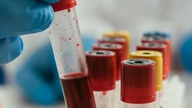 آزمایش ژنتیک خطر عود سرطان خون را پیش‌بینی می‌کند
