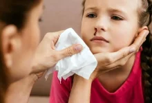 آیا هر خون‌دماغی در کودکان نگران‌کننده است؟ / پاسخ علمی رئیس انجمن خون و سرطان