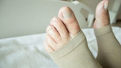 هشدار درباره لخته خون در پا / این علائم را جدی بگیرید