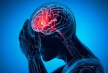 ارتباط میگرن با یک عارضه خطرناک در میانسالی