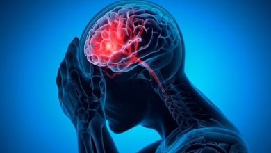 ارتباط میگرن با یک عارضه خطرناک در میانسالی
